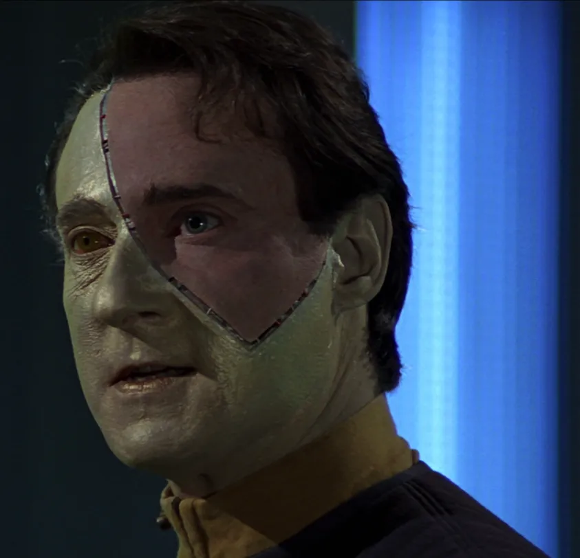 Data, with a portion of his face grafted with flesh-toned human skin