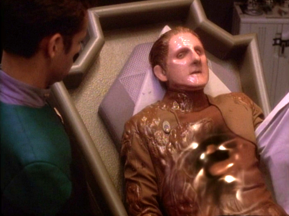 Odo looking sickly on a bed in sickbay