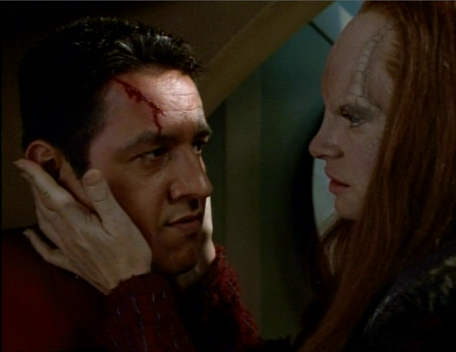 Seska gently holds Chakotay who has a bleeding gash on his forehead