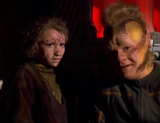 Neelix with a young girl who has scars on her face